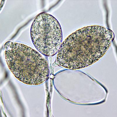 Sympodium of one immature, one empty and two mature semipapillate sporangia of a Phytophthora ramorum isolate